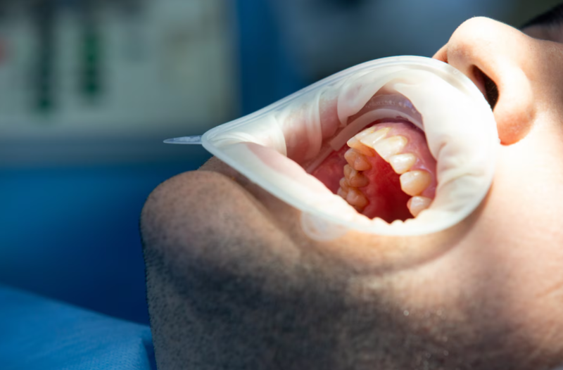 File:Screenshot 14asdw0.png